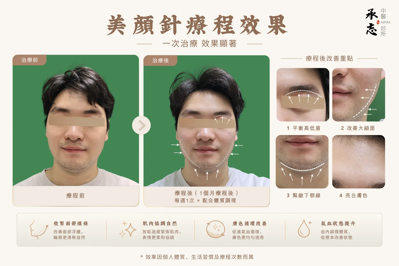 美顏針療程前後效果展示